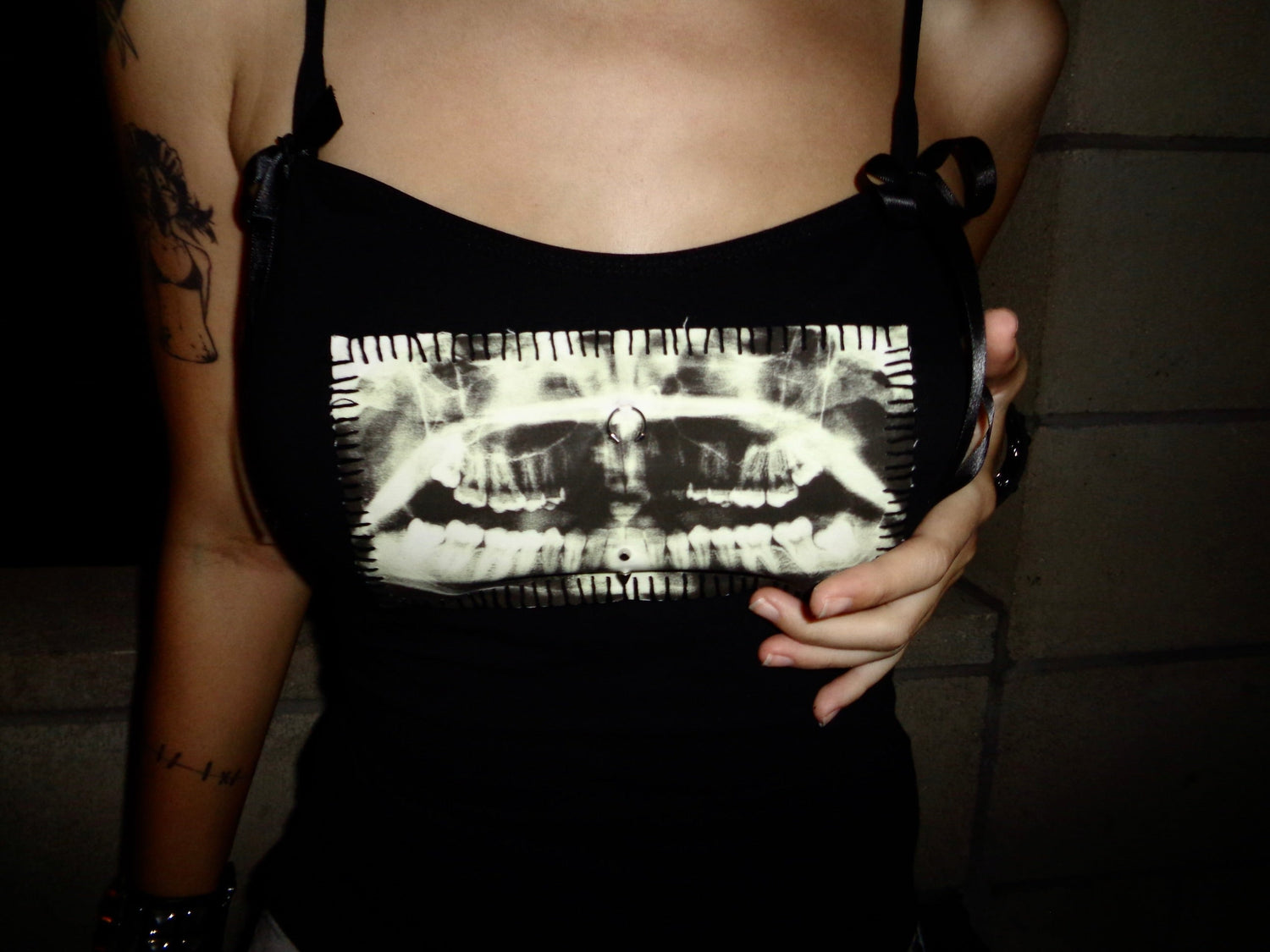Teeth X-Ray