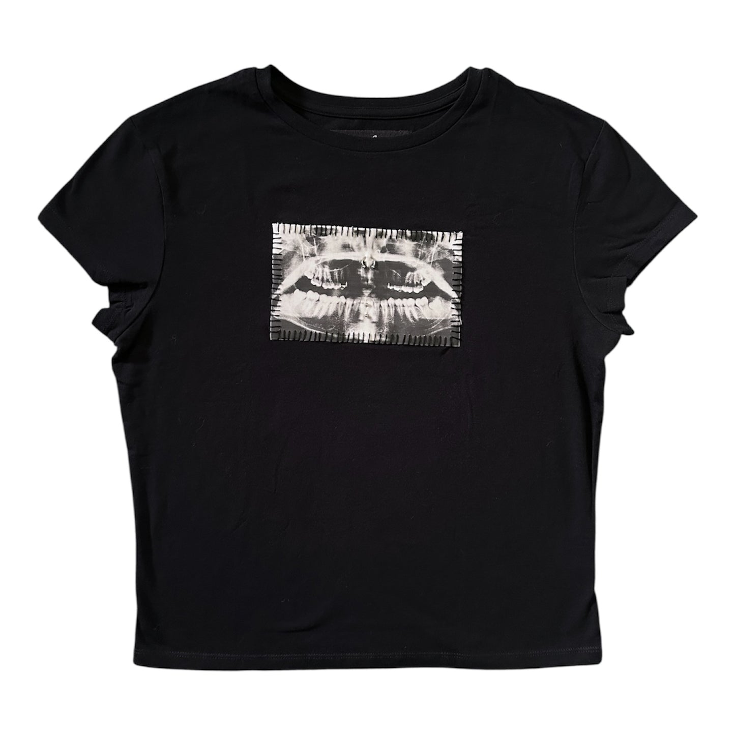 teeth x-ray baby tee