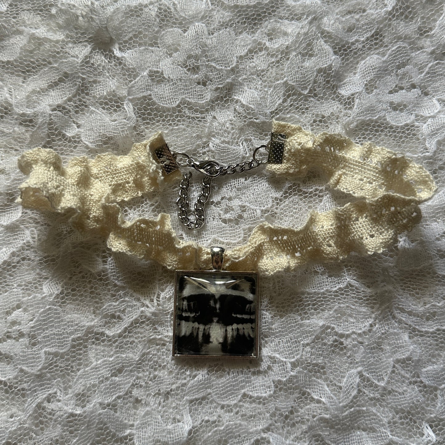 x-ray choker
