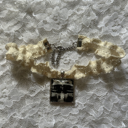 x-ray choker
