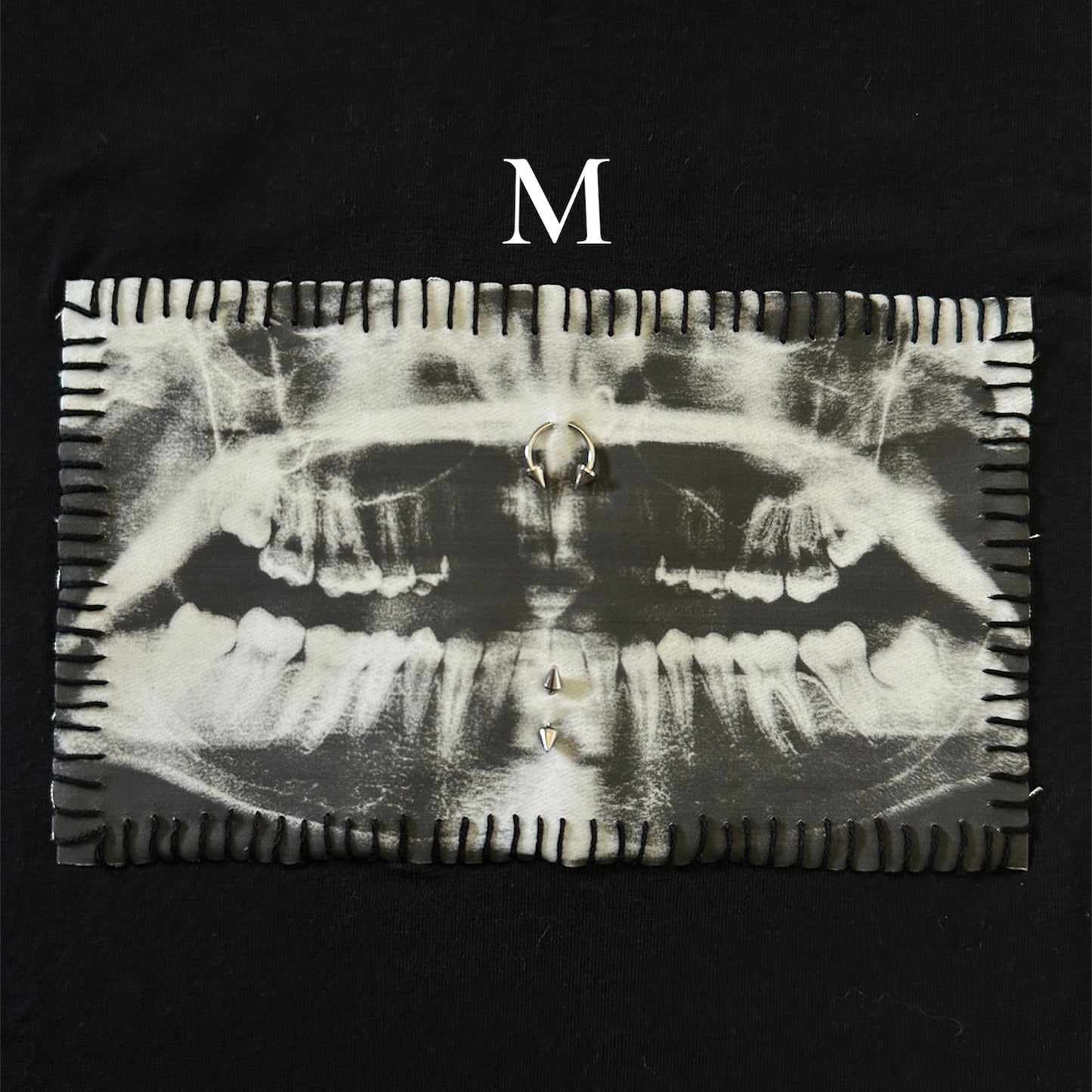 teeth x-ray baby tee