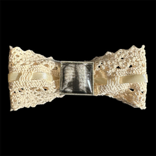 x-ray bow