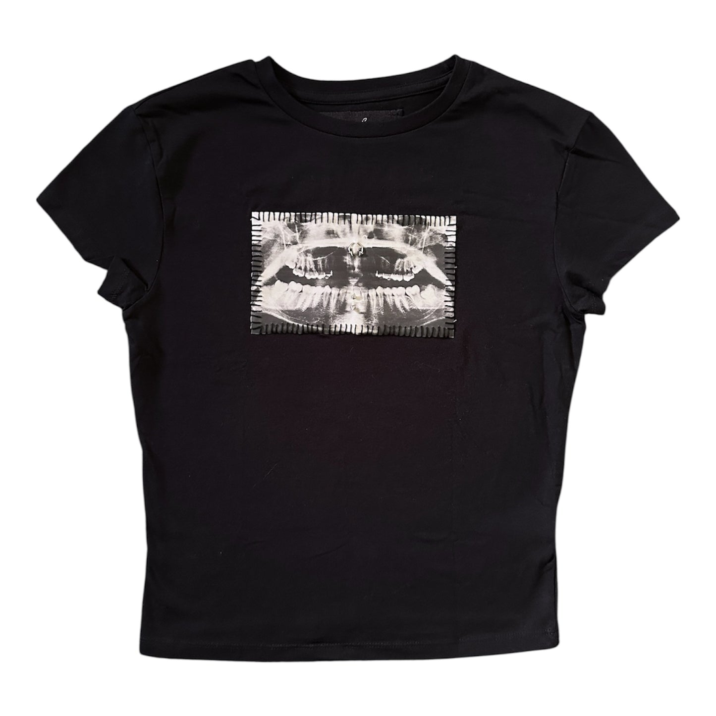 teeth x-ray baby tee