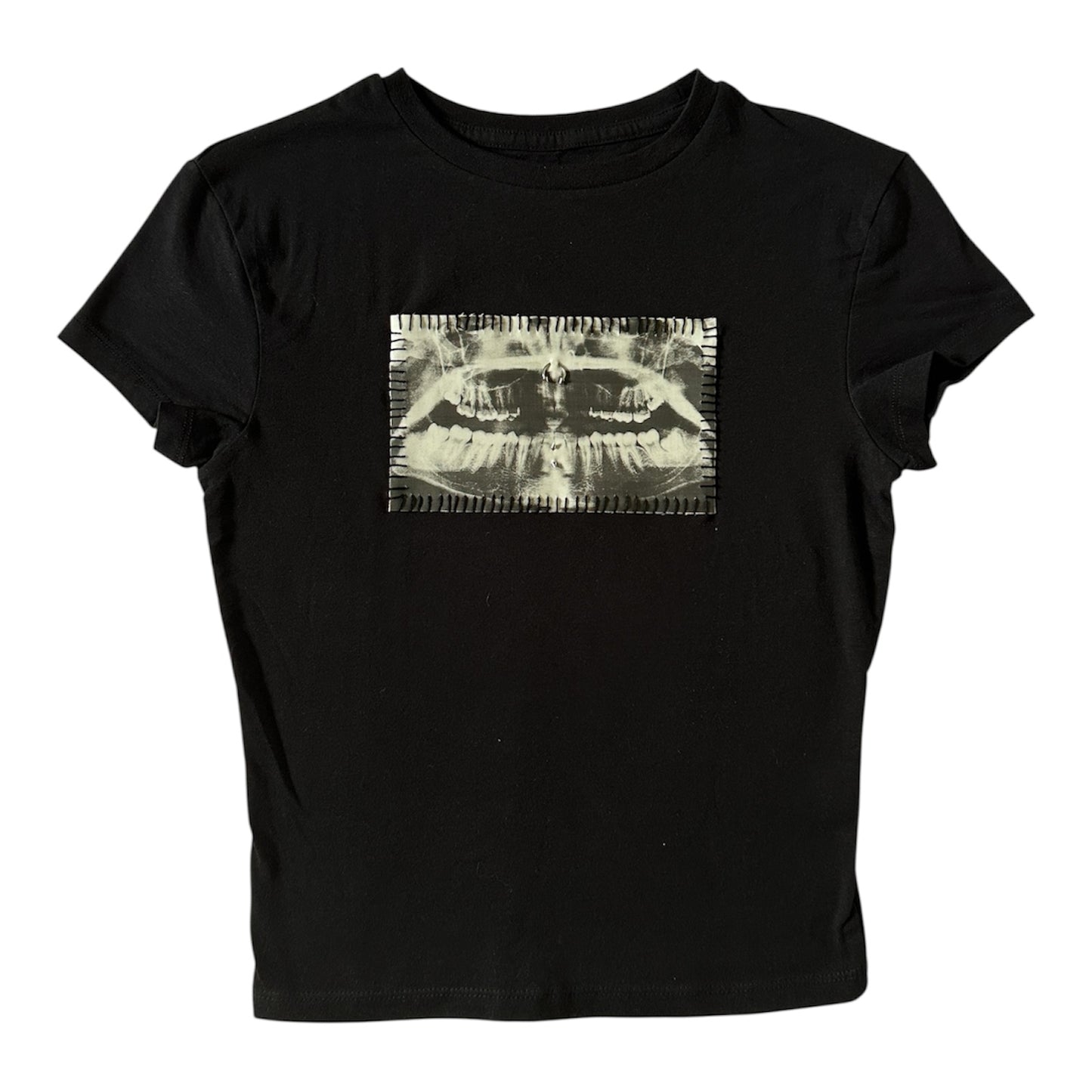 teeth x-ray baby tee