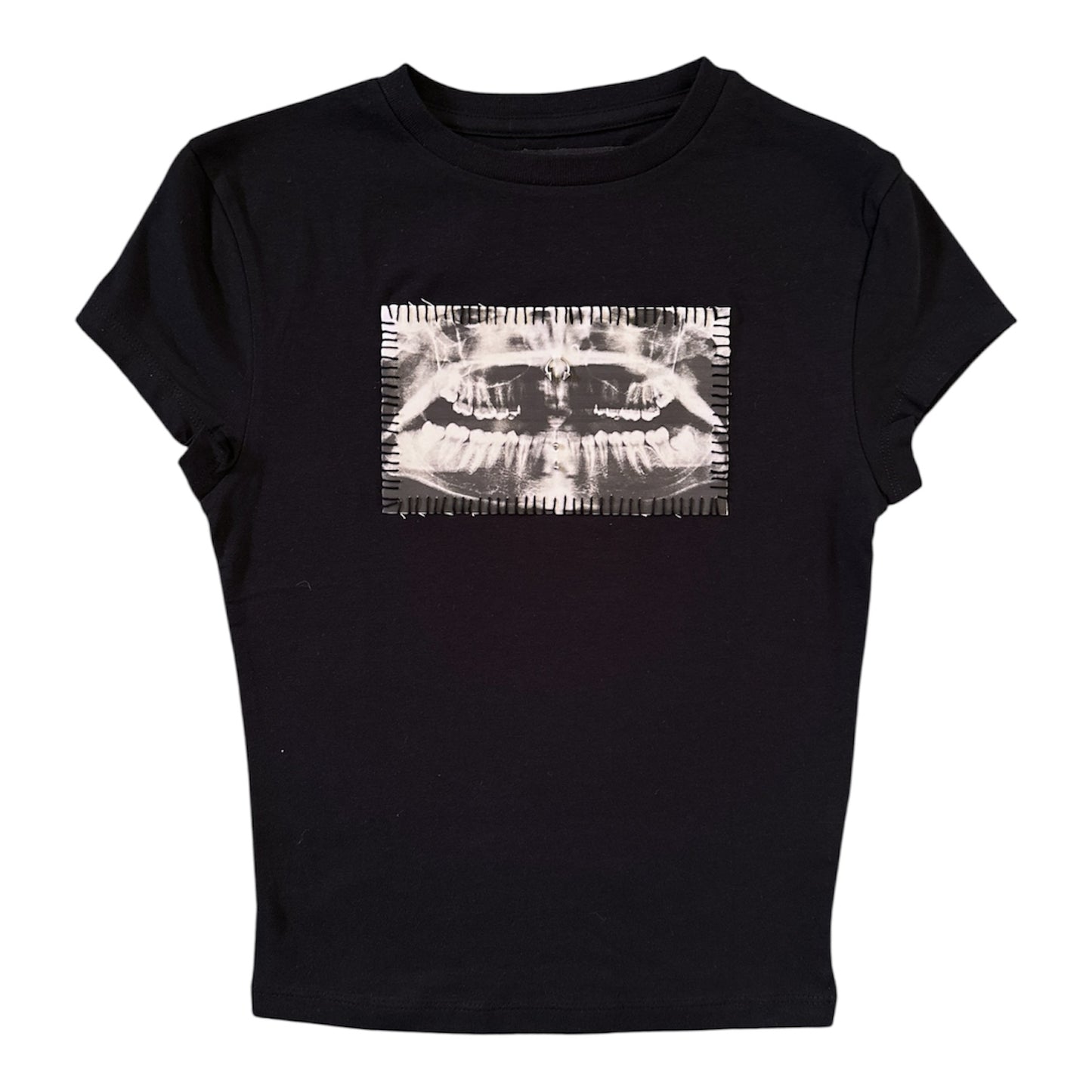 teeth x-ray baby tee