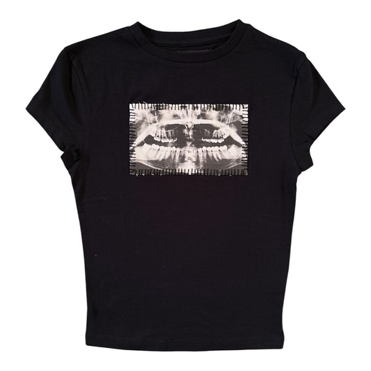 teeth x-ray baby tee