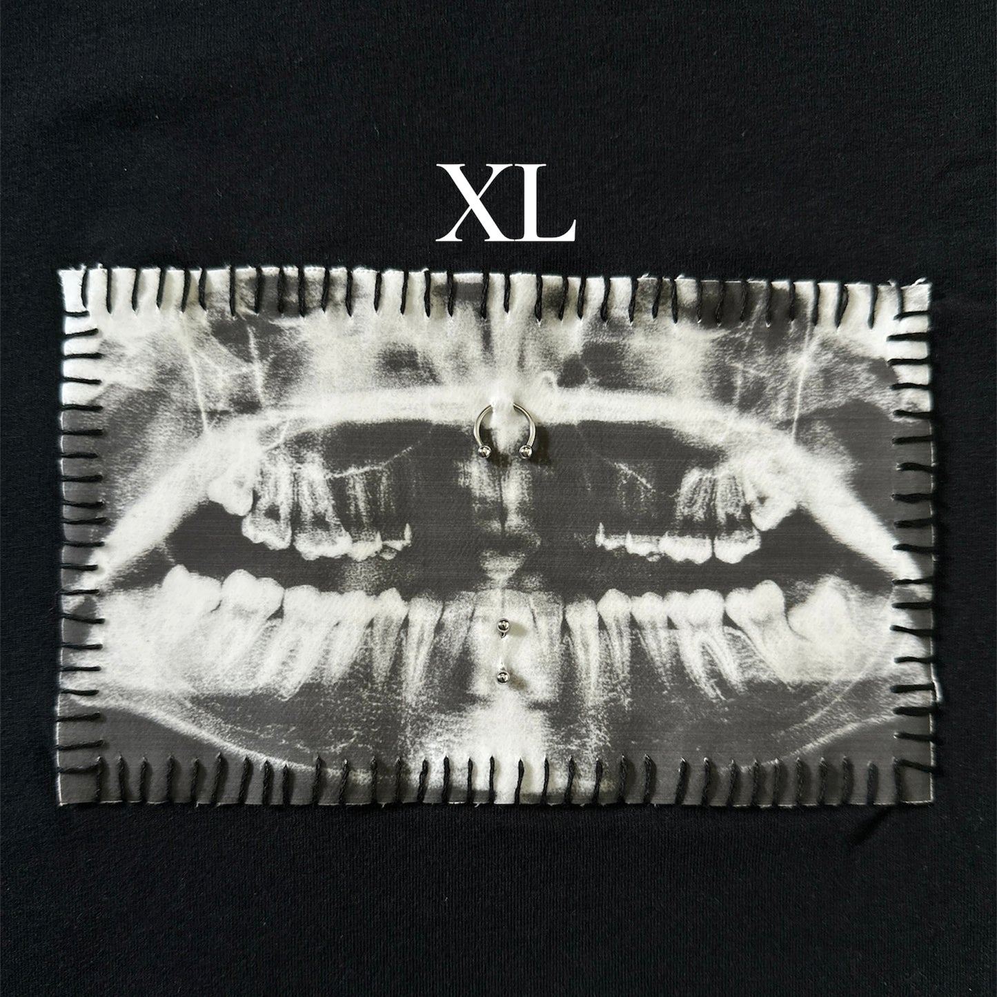 teeth x-ray baby tee