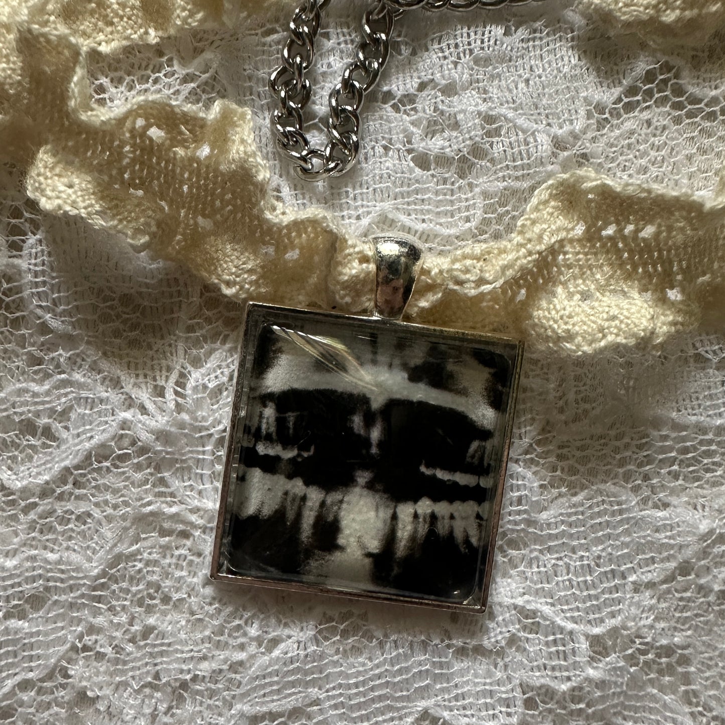x-ray choker