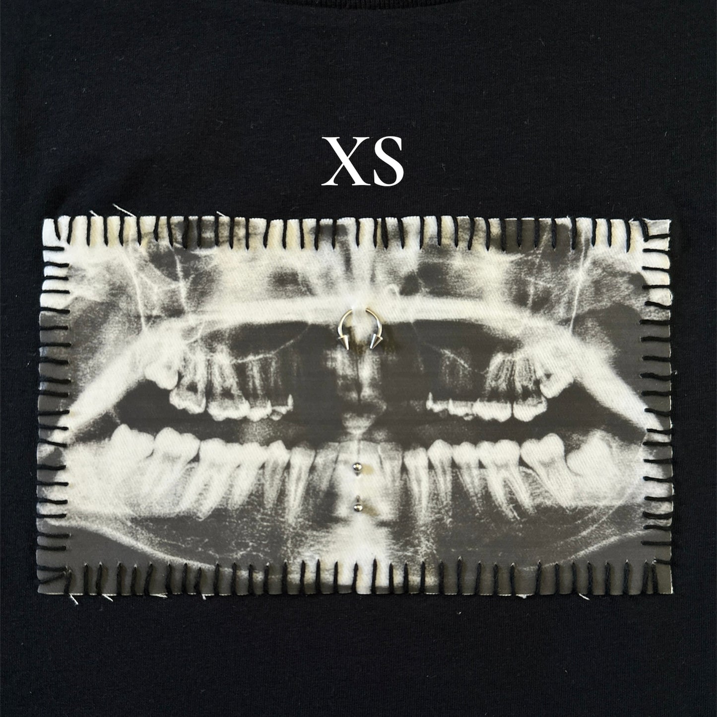 teeth x-ray baby tee